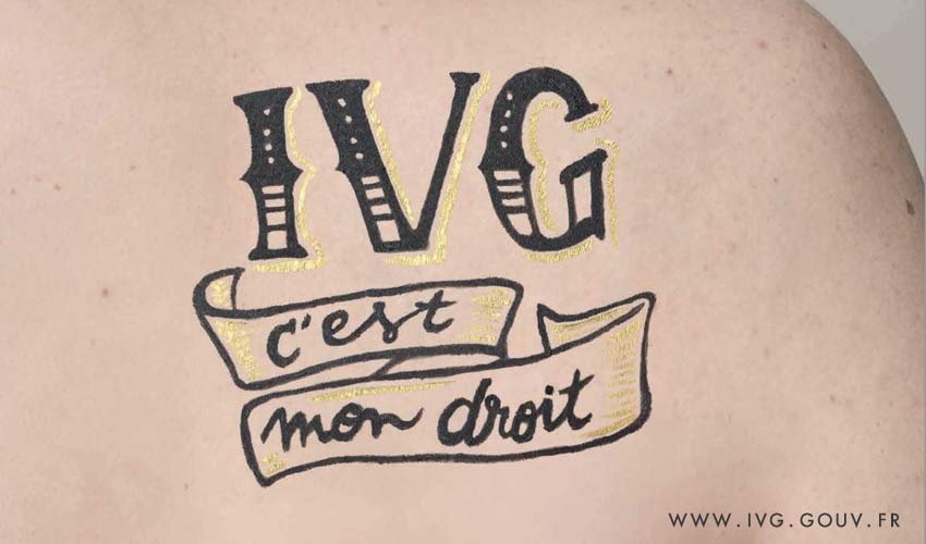 ivg