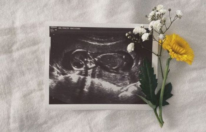 Taille images article TDM (4)