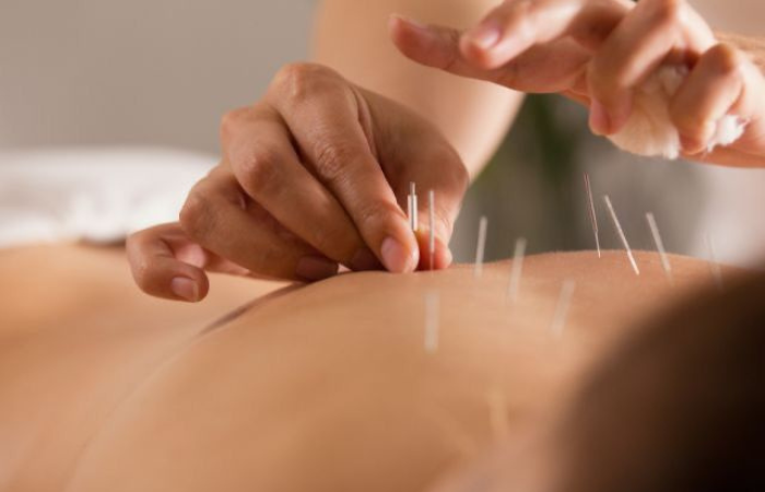 Acupuncture grossesse