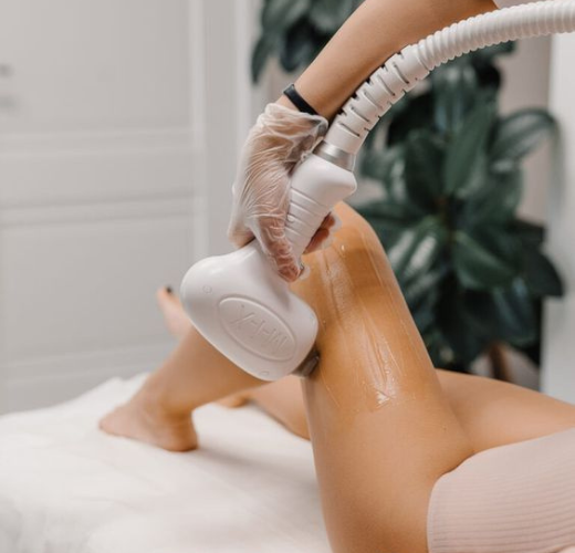 épilation-définitive-grossesse