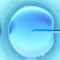 Fécondation in vitro